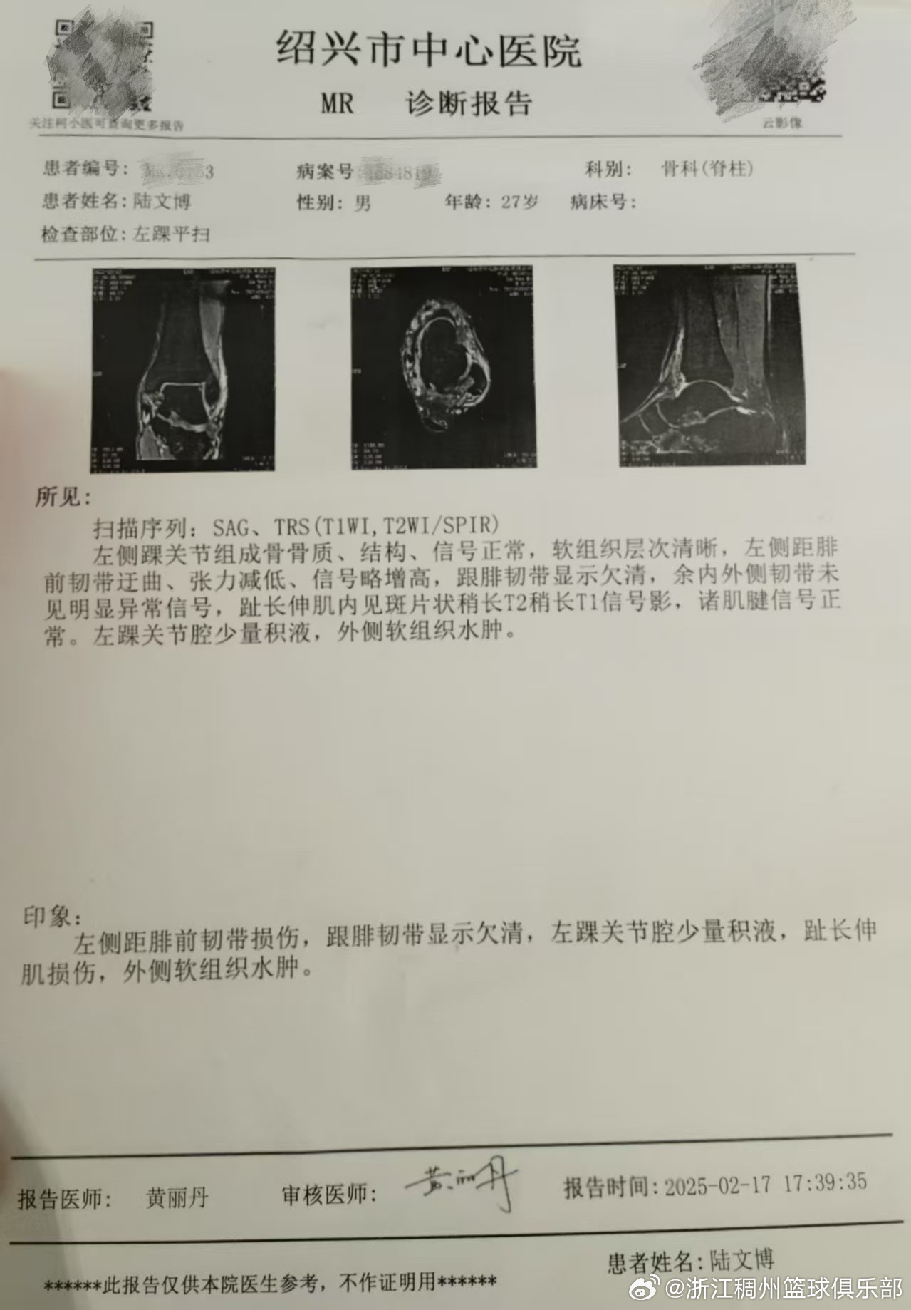 眼表现